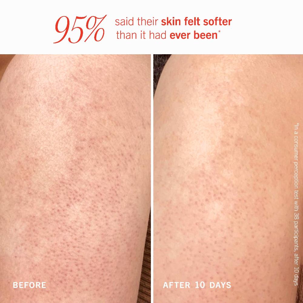 First Aid Beauty KP Bump Eraser Body Scrub 10% AHA Fresh Peach Travel Size Exfoliator