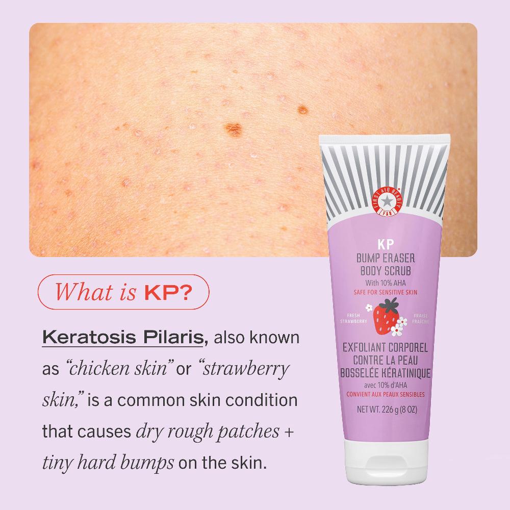 First Aid Beauty KP Bump Eraser Body Scrub 10% AHA Fresh Strawberry Travel Size Exfoliator