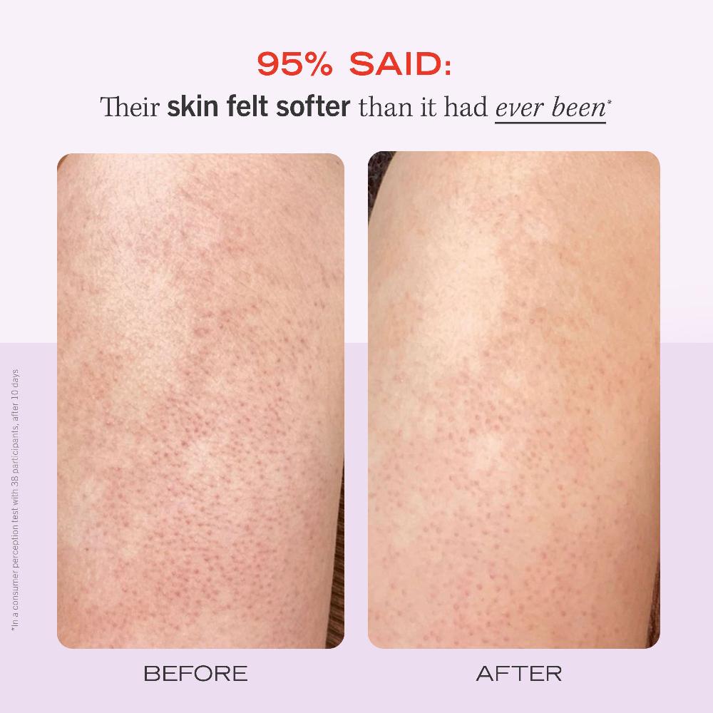 First Aid Beauty KP Bump Eraser Body Scrub 10% AHA Fresh Strawberry Travel Size Exfoliator
