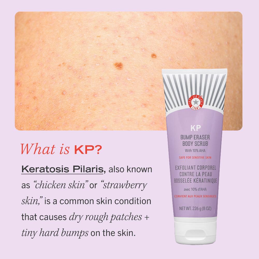 First Aid Beauty KP Bump Eraser Body Scrub Mini Exfoliator