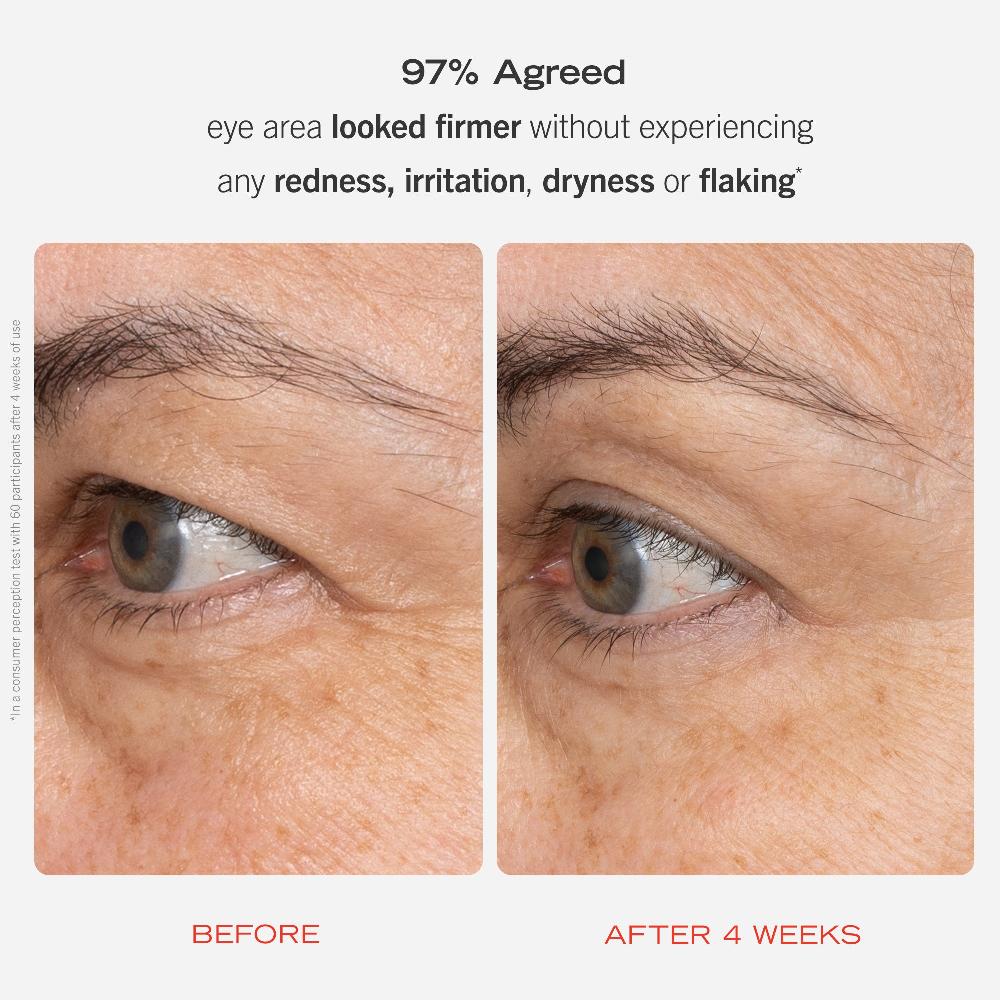 First Aid Beauty Retinol Eye Cream With Squalane + Ceramides Eye Cream