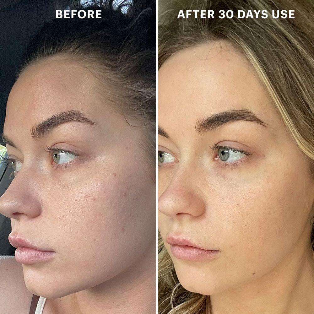 Glo Minerals Beta-Clarity BHA Drops
