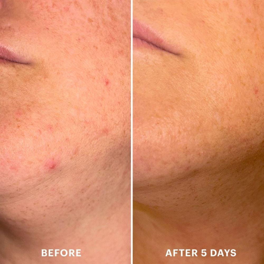 Glo Minerals LED Spot Device