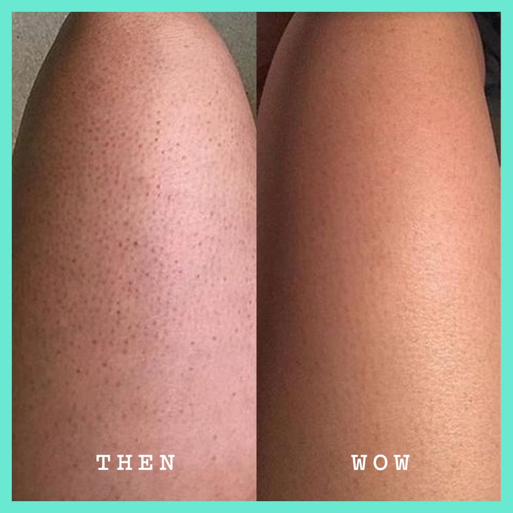 Frank Body Glycolic Body Scrub