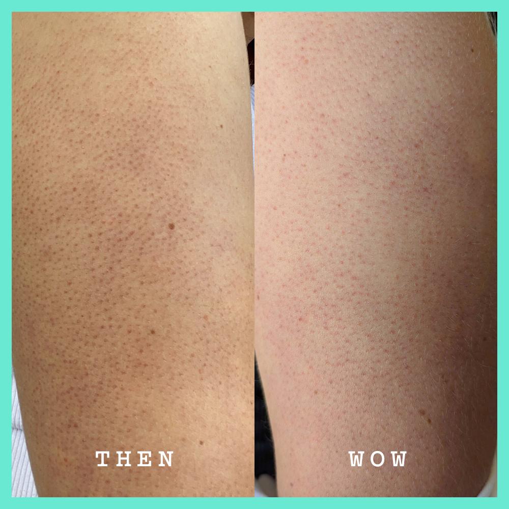 Frank Body Glycolic Body Scrub