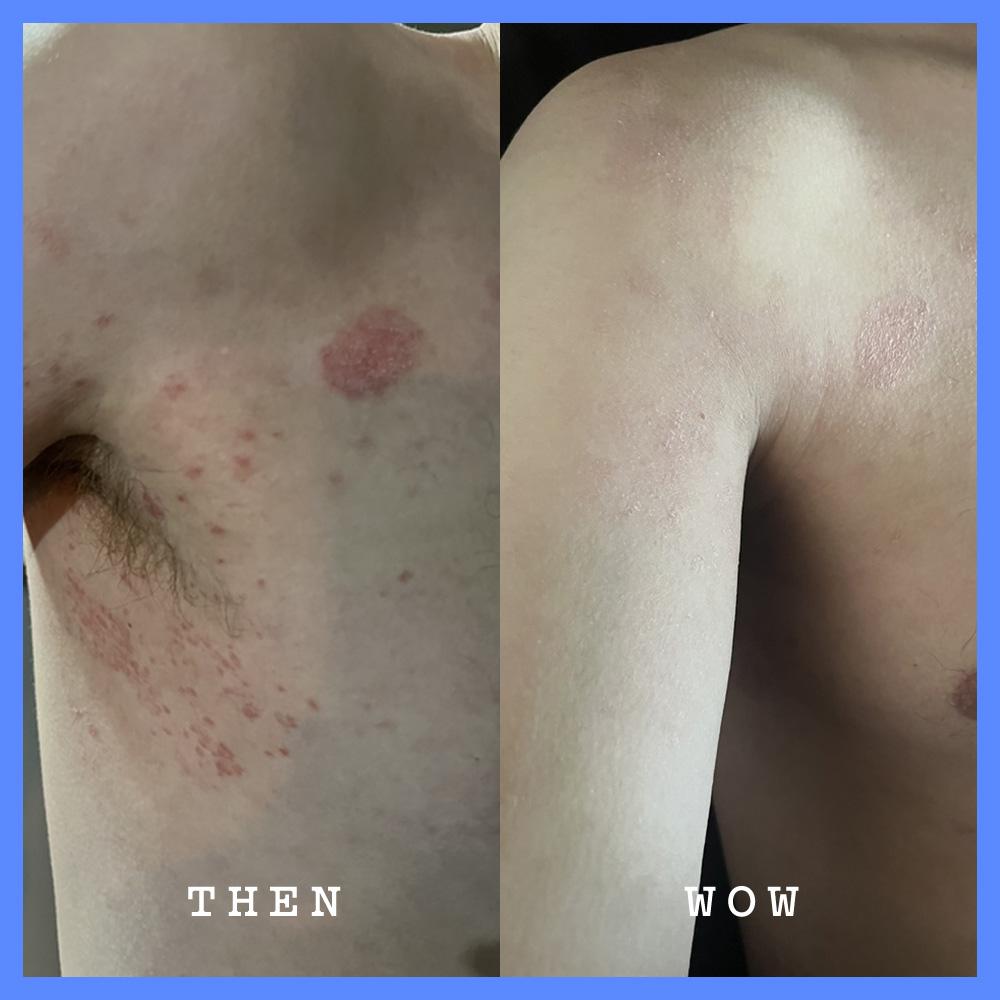 Frank Body Hyaluronic Acid Body Serum