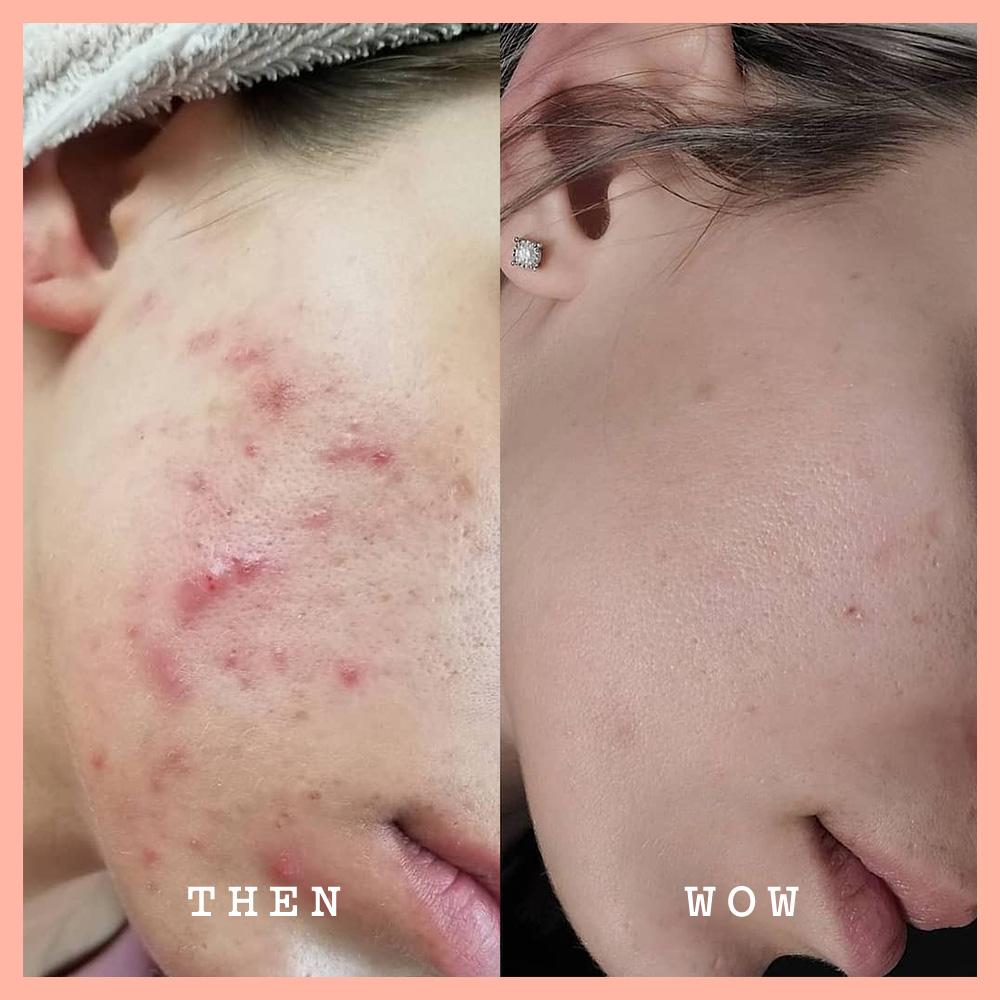 Frank Body Original Face Scrub