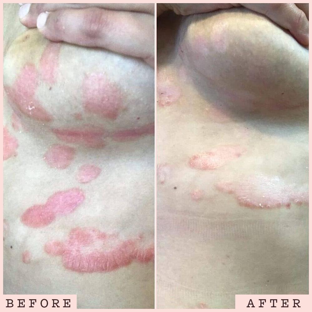 Frank Body The Original Power Couple