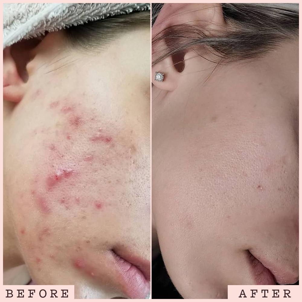 Frank Body The Original Power Couple