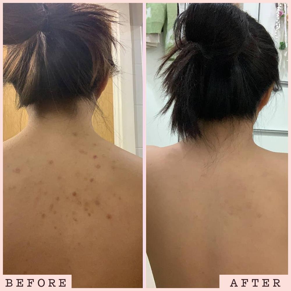 Frank Body The Original Power Couple