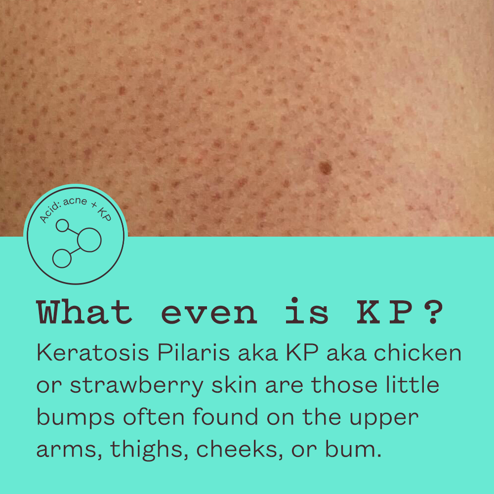 Frank Body Triple Acid Body Duo