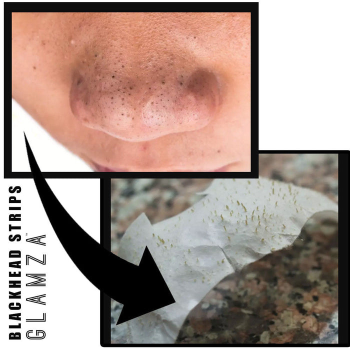 Glamza Glamza Deep Cleansing Nose Strips For Blackheads