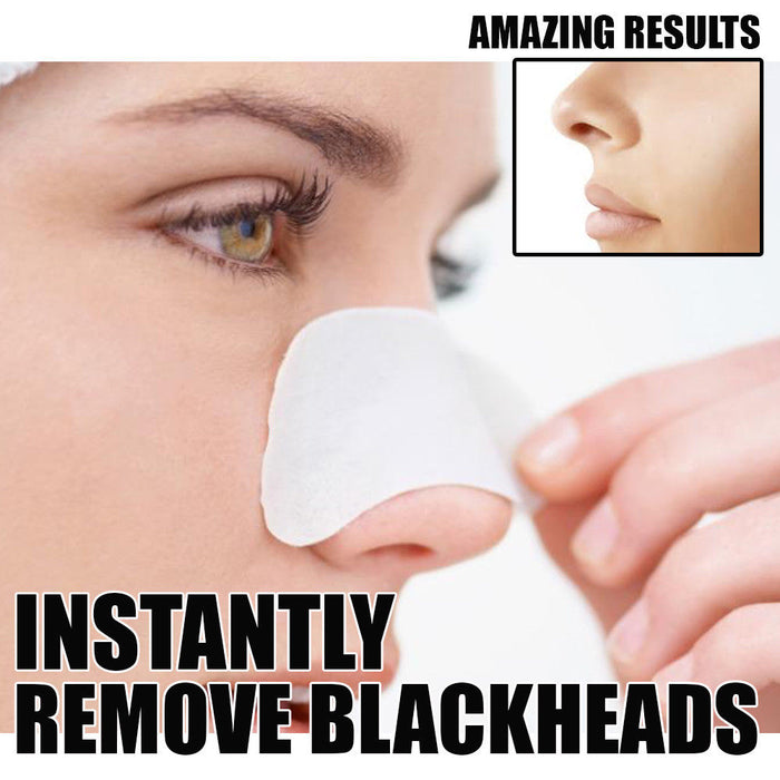 glamza Glamza Deep Cleansing Nose Strips for Blackheads
