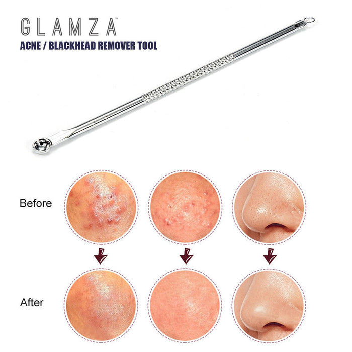 Glamza Glamza Double Ended Spot Removal Tool