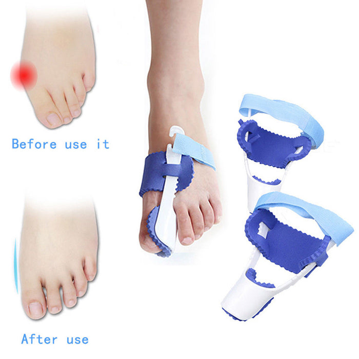 Glamza Glamza Splint Corrector Device Pair