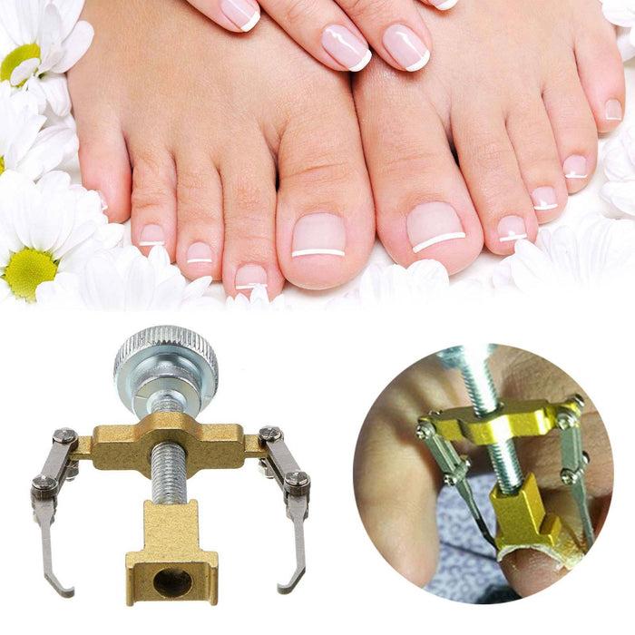 Glamza Ingrown Toenail Corrector Clamp