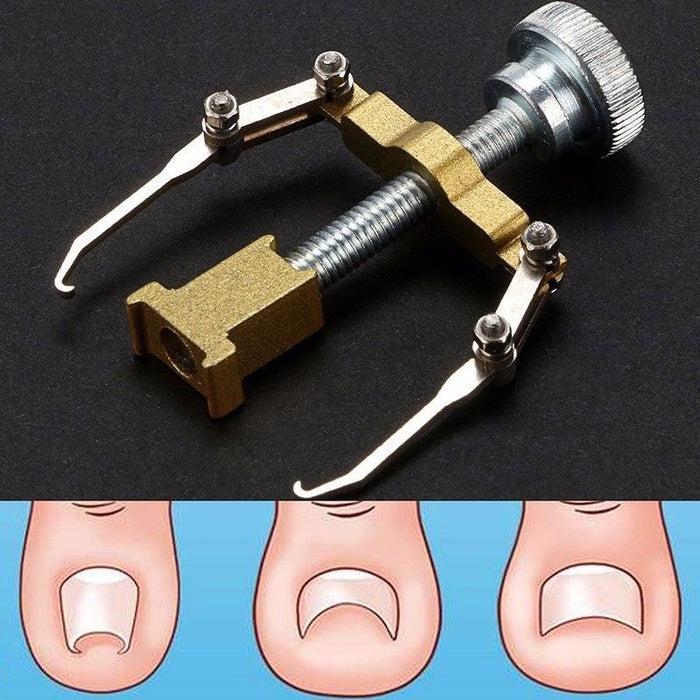 Glamza Ingrown Toenail Corrector Clamp