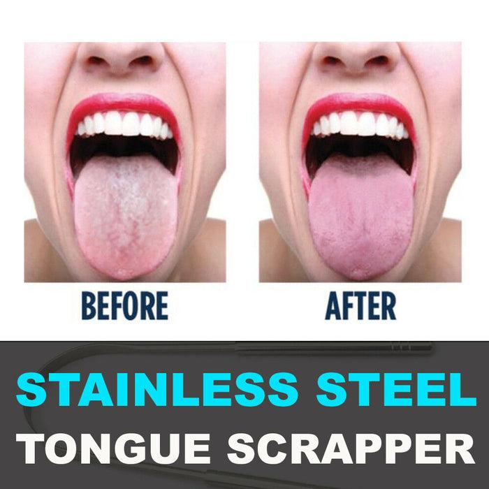 Glamza Glamza Stainless Steel Tongue Scraper | Unisex Oral Care | Free UK Delivery