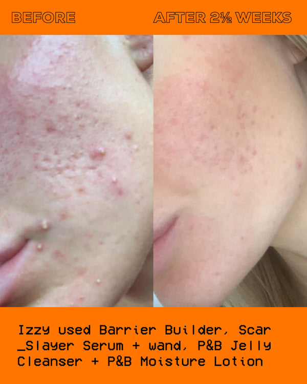 glow Hub The Scar Slayer Facial Serum