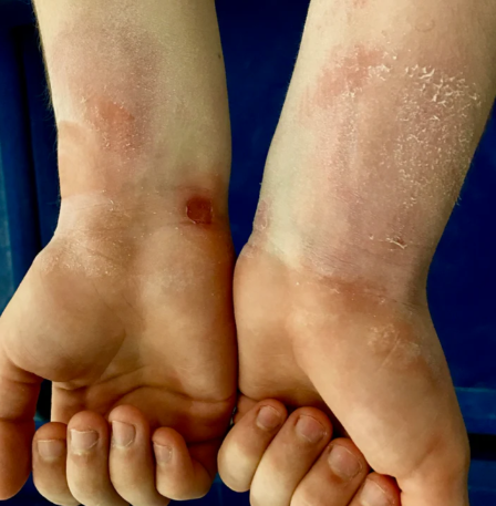 Gmd DRYband Wristbands - Black