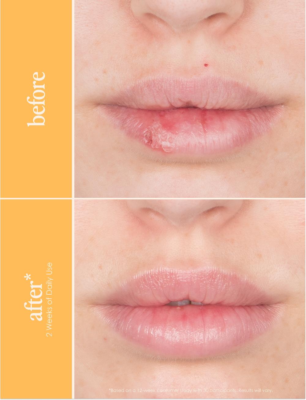 Grande Cosmetics GrandePOUT Plumping Lip Mask Berry Mojito