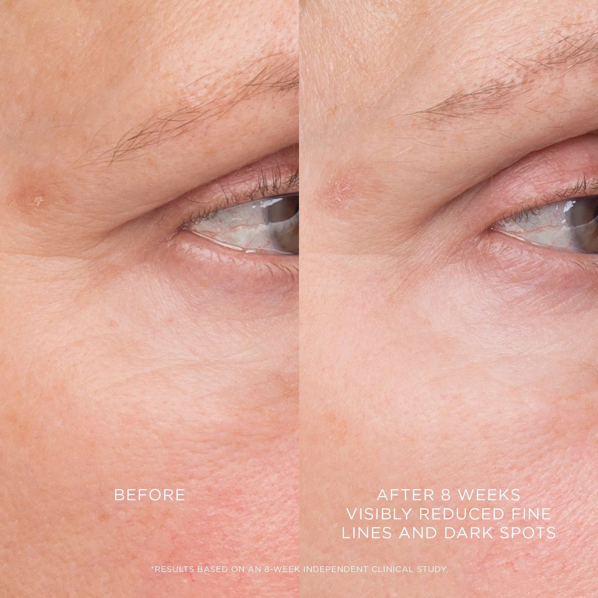 Hourglass Equilibrium Resurfacing Retinoid Treatment