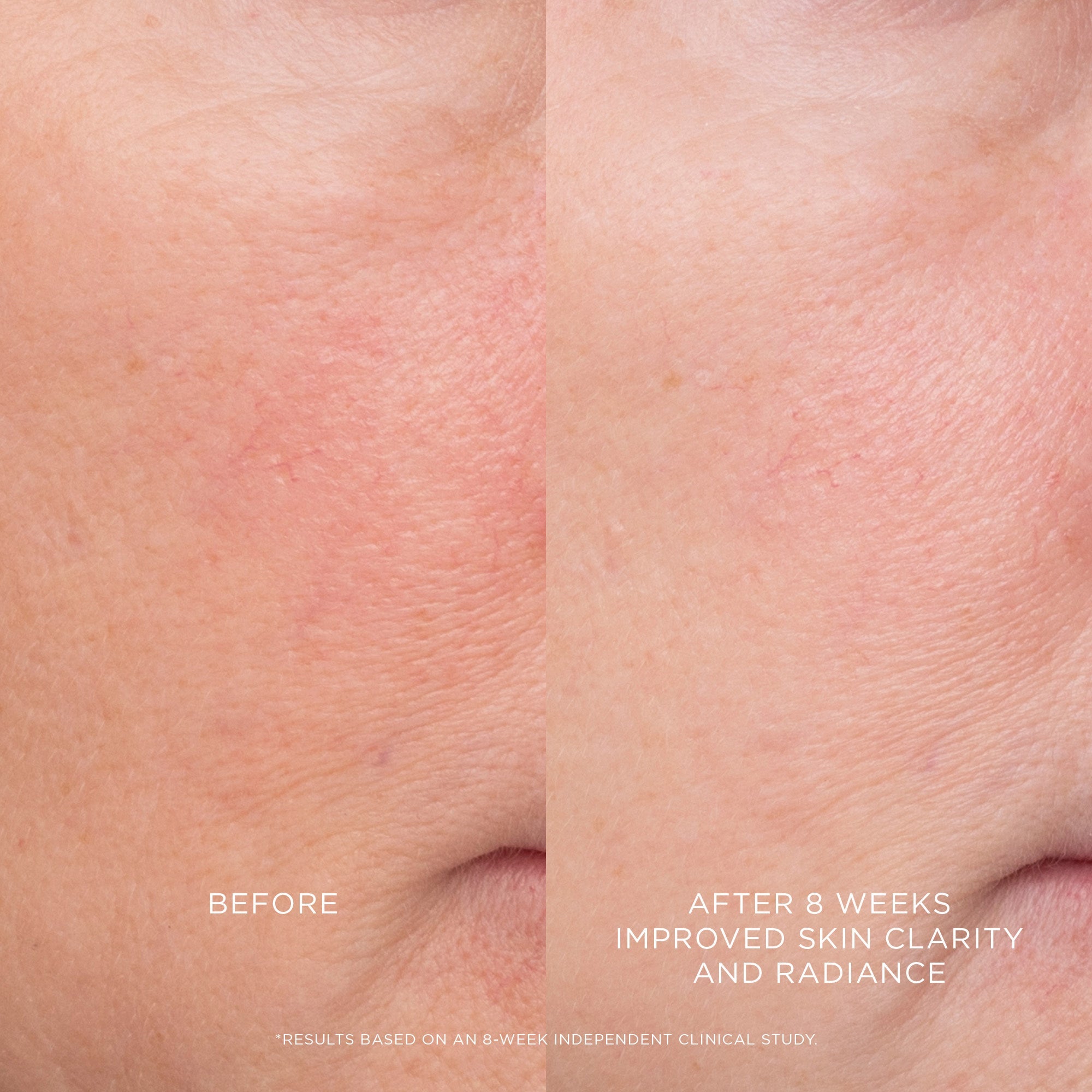 Hourglass Equilibrium Resurfacing Retinoid Treatment