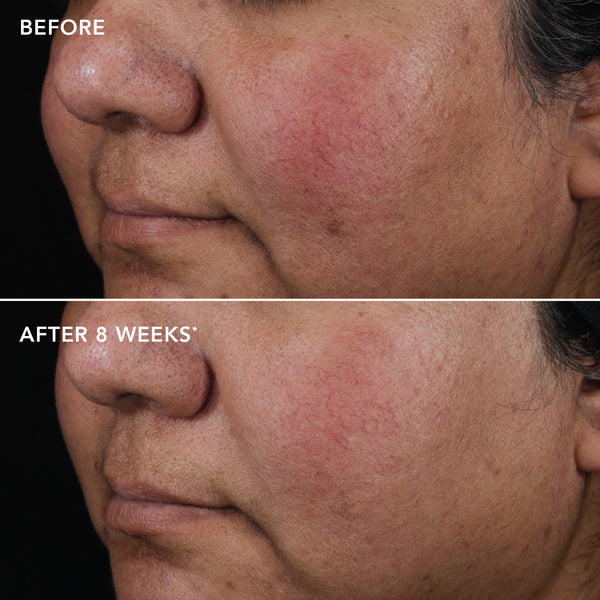Image Skincare AGELESS+ Retinol Pure Liquid Retinol 0.75%