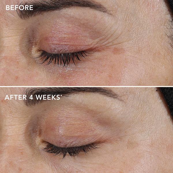 Image Skincare AGELESS+ Retinol Repair Crème 0.3% Retinol Complex (travel Size)