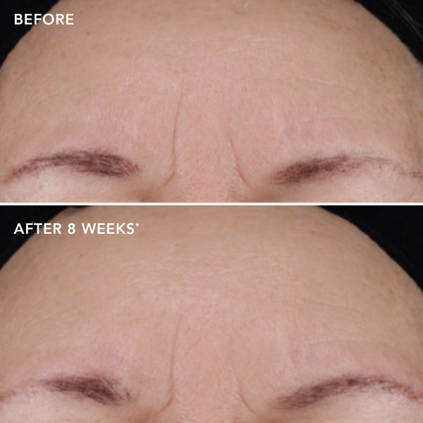 Image Skincare AGELESS+ Retinol Treatment Crème 1.2% Retinol Complex