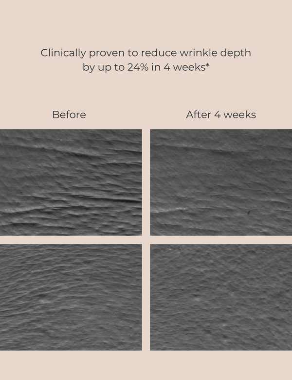 Inika Bakuchiol Serum Natural Retinol Alternative 30mL