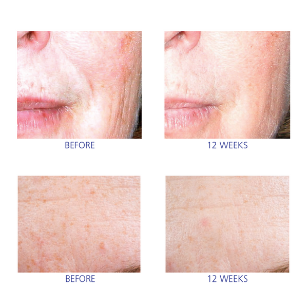 Is Clinical Active Serum By IS Clinical UK