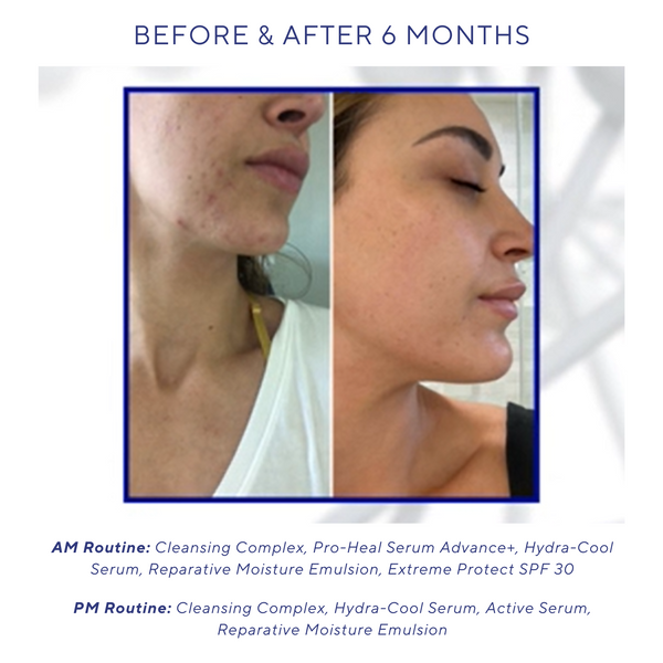 Is Clinical Hydra-Cool Serum By IS Clinical UK