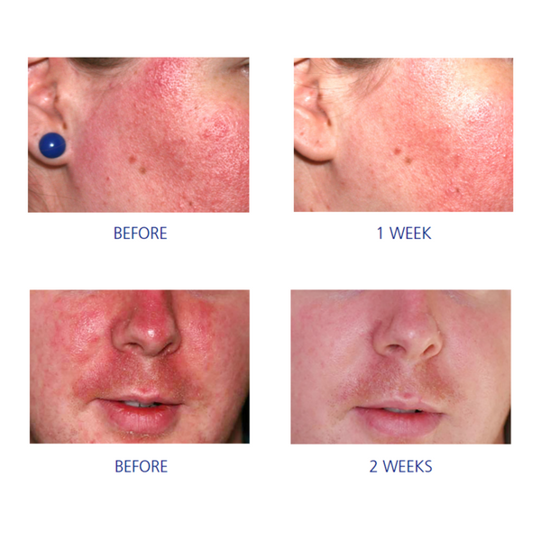 Is Clinical Pro-Heal Serum By IS Clinical UK