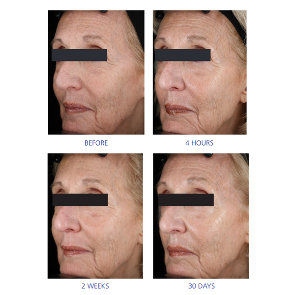Is Clinical Youth Eye Complex By IS Clinical UK
