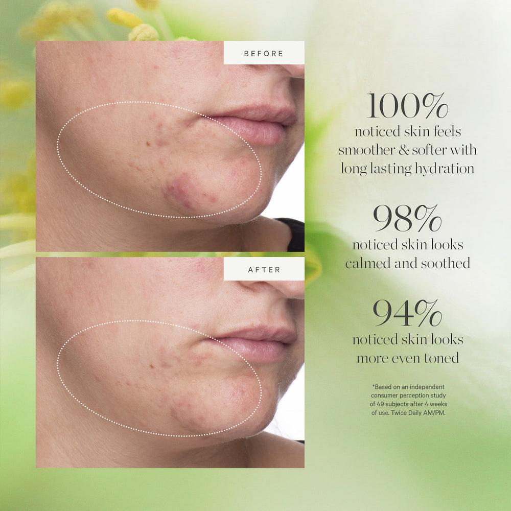 Kora Organics Active Algae Lightweight Moisturizer - Archive Sale