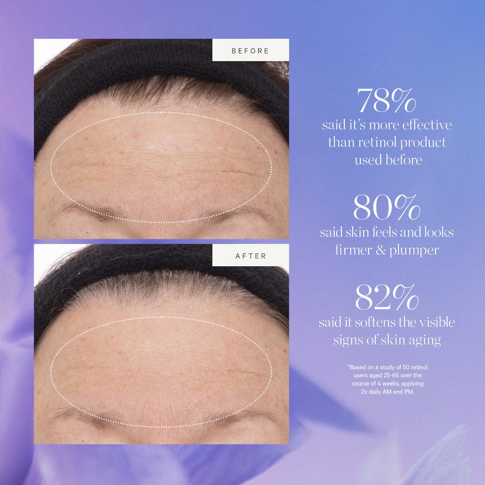 Kora Organics Plant Stem Cell Retinol Alternative Serum - Archive Sale