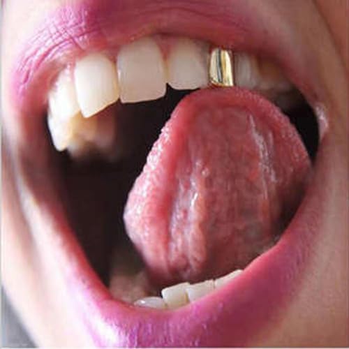 Gold Grills For Teeth 18K Gold Plated Tooth Caps Single Teeth Caps Hip Hop Grillz