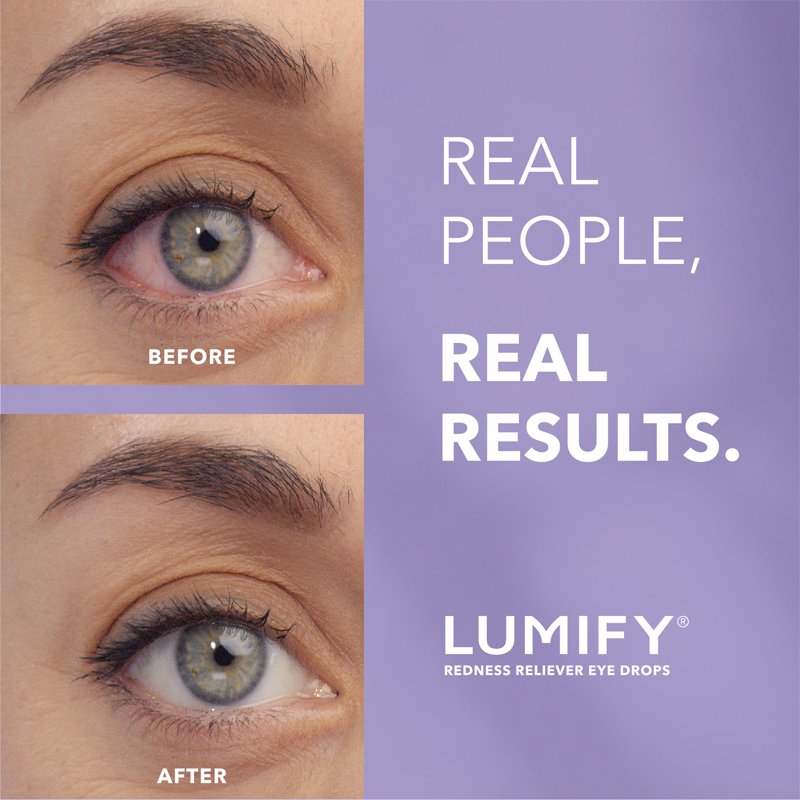 LUMIFY Eye Drops For Redness Relief And Whiter And Brighter Looking Eyes .25 Fl Oz (7.5 Ml)