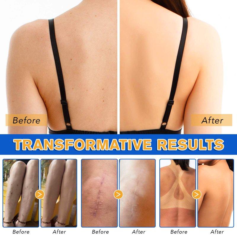 Yecuce Leg Makeup For Cover Varicose Vein Body Foundation For Scar Flawless Coverage Waterproof & Long Lasting (Fairest Glow)