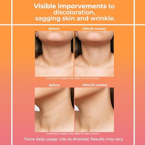 Bestkiss Neck Cream For Tightening And Firming: Anti Aging Anti Wrinkles Reduces Neck Lines Fine Lines - Retinol Niacinamide Squalane Hyaluronic Acid Ceramides Cruelty Free Paraben Free 80g