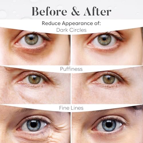 BLOOMORA Variety Under Eye Patches (30 Pairs) - Dark Circles & Puffy Eyes Treatment - Eye Care Mask For Refreshment - 6 Varieties