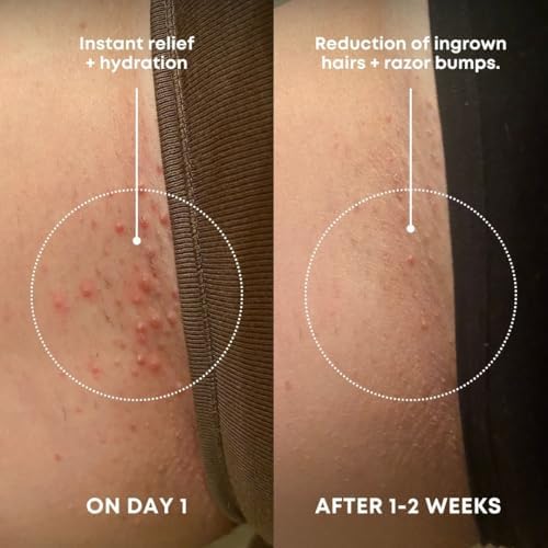 Bushbalm Ingrown Hair Exfoliating Scrub - Reduces Appearance Of Ingrown Hairs And Razor Bumps Soothes Skin And Post-Shave Redness - Watermelon Sugar 236 Ml