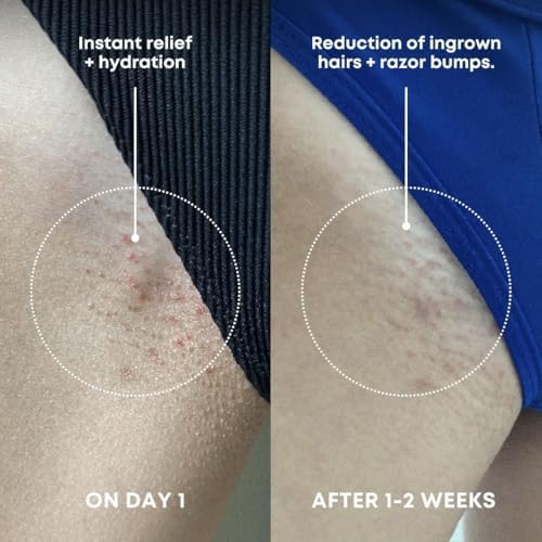 Bushbalm Ingrown Hair Exfoliating Scrub - Reduces Appearance Of Ingrown Hairs And Razor Bumps Soothes Skin And Post-Shave Redness - Watermelon Sugar 236 Ml