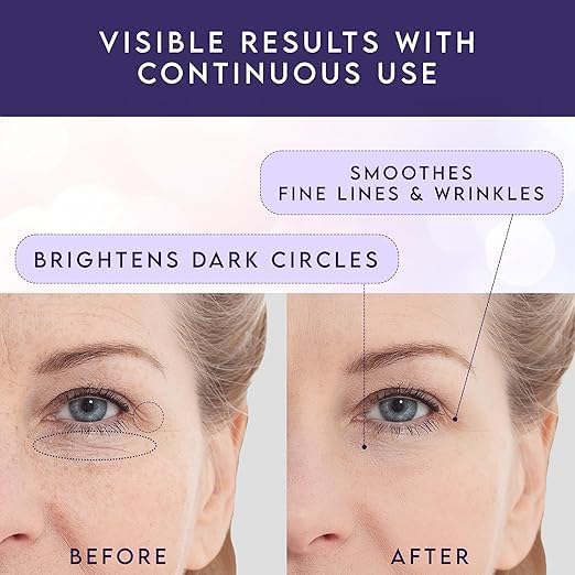 Eye Cream Stick For Dark Circles And Puffines – Under Eye Brightener Eye Balm Stick – Caffeine Eye Cream For Wrinkles Bags & Fine Lines – 2 Packs