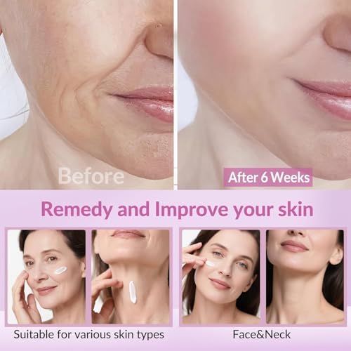 Neck Firming Creams For Tightening And Firming Moisturizer Face Cream With Collagen Hyaluronic Acid Day & Night Anti-Aging Skin Tightening Cream Neck Décolleté & Face – 51ml