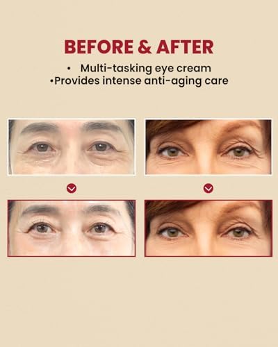 Seoul 1988 Eye Cream: Retinal Liposome 4% +Fermented Bean 30ml