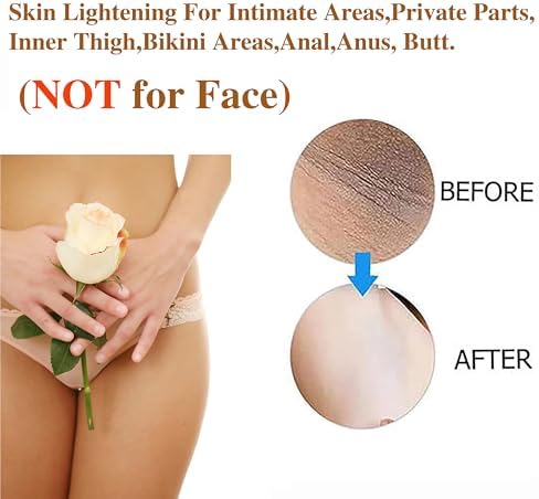 Skin Lightening Cream Skin Bleaching Cream For Body Intimate Area Private Parts Underarm Knees Elbows Inner Thigh Bikini Areas Skin Whitening Dark Spot Remover For Body Intimate Part