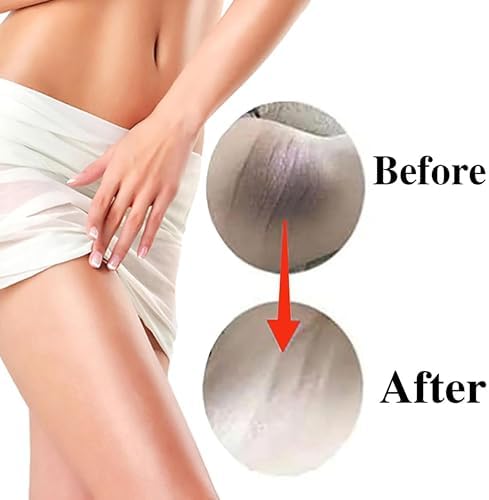 Skin Lightening Cream Skin Bleaching Cream For Body Intimate Area Private Parts Underarm Knees Elbows Inner Thigh Bikini Areas Skin Whitening Dark Spot Remover For Body Intimate Part