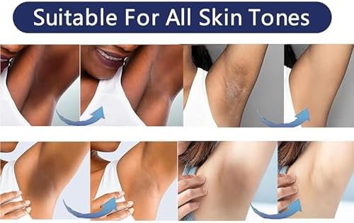 Skin Lightening Cream Skin Bleaching Cream For Body Intimate Area Private Parts Underarm Knees Elbows Inner Thigh Bikini Areas Skin Whitening Dark Spot Remover For Body Intimate Part